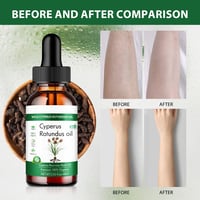 Cyperus Rotundus Skin Serum Natural Hair Removal Oil