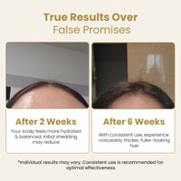 Image 4 of By Mayam Beauty Minoxidil + Bergamota Hair Tonic 