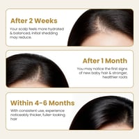 Image 5 of By Mayam Beauty Minoxidil + Bergamota Hair Tonic 