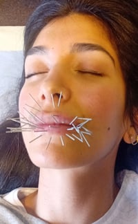 Image 2 of Cosmetic & Aesthetic Acupuncture 