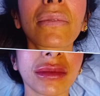 Image 5 of Cosmetic & Aesthetic Acupuncture 