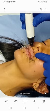 Image 6 of Cosmetic & Aesthetic Acupuncture 