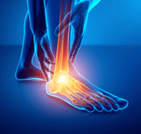 Image 14 of PAIN RELIEF BALM