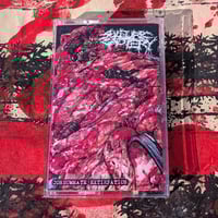 SULFURIC CAUTERY "CONSUMMATE EXTIRPATION" PROTAPE