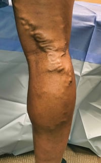 Image 2 of The Art of Blood Letting