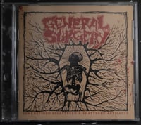 Image 1 of General Surgery - Semi Retired Splattered & Shattered Artifacts - CD