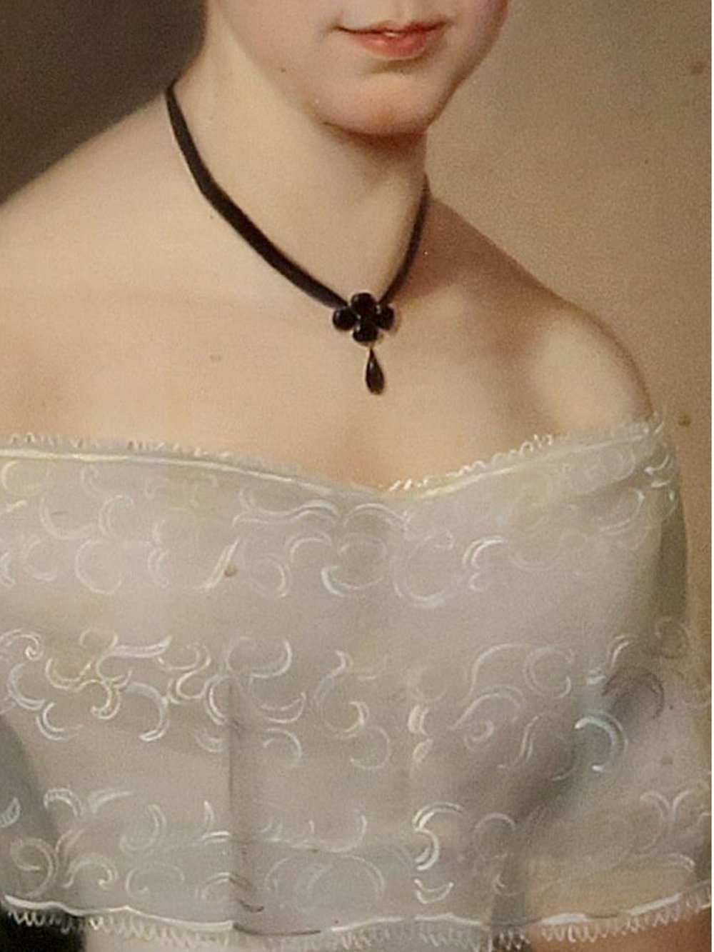 Image of CT NECK ⼺2