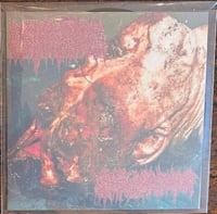 Cystic Hygroma / Cryptosporidiosis - Split CDr