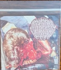 Intracerebral Hemorrhage - 2024 Demo 2 Mini CDr