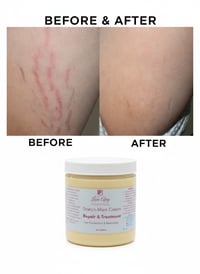 Image 1 of Strech Marks Cream