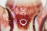 Image 3 of TPT A0020