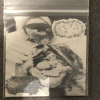 Hydroencephalocystocele / Lymphogranulomatous Erythematous Parapharyngitis - Split Mini CDr