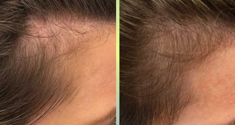 SCALP/HAIR. Batana/Burdock/Nettle/Buckthorn/Cayenne Skin & Scalp Medicinal Oils/Butters 