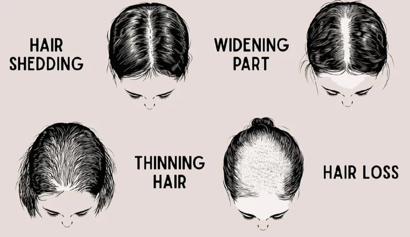 SCALP/HAIR. Batana/Burdock/Nettle/Buckthorn/Cayenne Skin & Scalp Medicinal Oils/Butters 