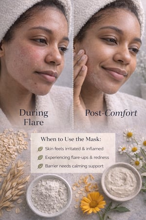 Image of Flare Relief Dry Mask