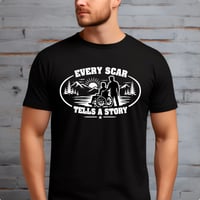 Every scar tells a story