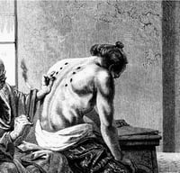 Image 4 of ༄ MOXIBUSTION ༄