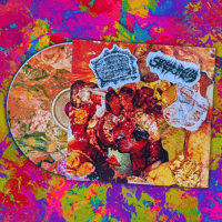 Sirenomelia / Necrotizing Fasciitis CDR