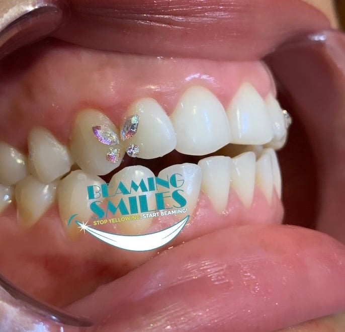 DIY Tooth Gem Jewelry Crystal Diamond Teeth Decoration w/ Curing Light Glue