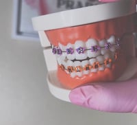 Flower braces display 