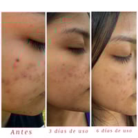 Image 2 of Curcuma Golden Renewal | Handmade Artisan Facial Soap 