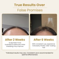 Image 4 of By Mayam Beauty Minoxidil + Bergamota Hair Tonic 