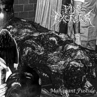 Image 1 of Pus Excretor ''Malignant Pustule'' - Cassette