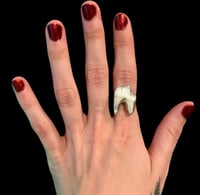 *CUSTOM * Tooth Ring