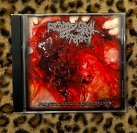 Rigidity Spinal Deformity "Polytraumatic Explorations" Album