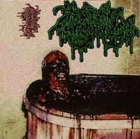 Putrefying Thyrotoxicosis – The Five Demos Trilogy CS