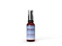 Image 1 of ACNE TREATMENT