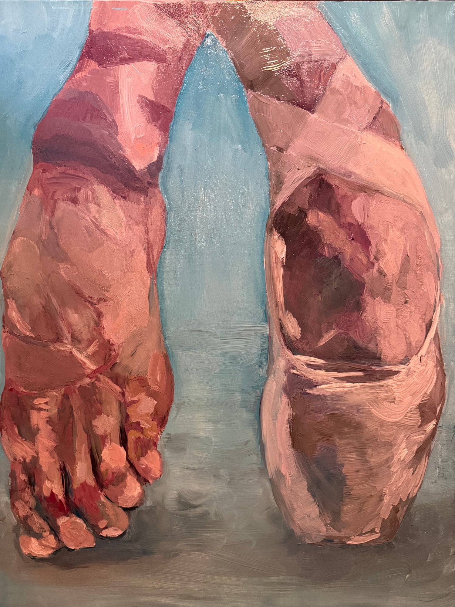 Painting - War wounds
