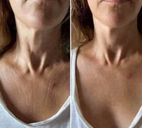 Image 2 of Firm Skin Decollete & Neck 
