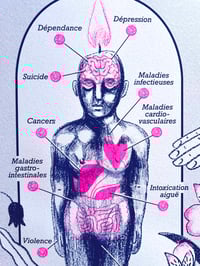 Image 2 of Poster Non Merci