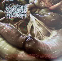 Image 1 of Lymphatic Phlegm / Flesh Grinder - Split 12''