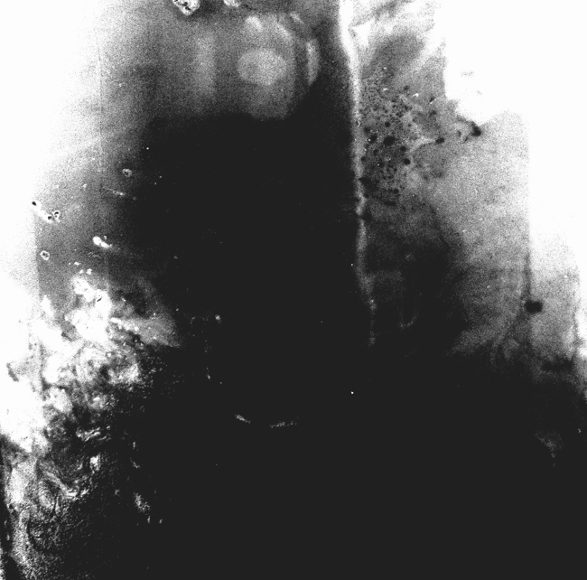 EPIMYTH - Benzalkonium