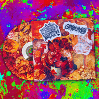 Sirenomelia / Necrotizing Fasciitis - Split 2025 CDR