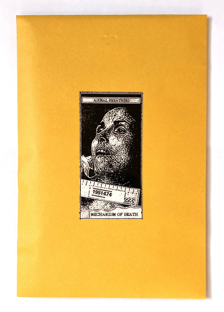 Image of Agonal Breathing - Mechanism of Death cs