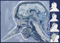 Migraine A4 print 