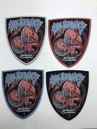 Official Malignancy - Intrauterine Cannibalism