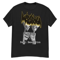 Image 1 of Metrorrhagia Fetal Resorption T-shirt