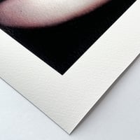 Image 2 of PROCEDURE