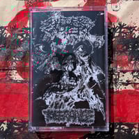 SULFURIC CAUTERY/TOLERANCE SPLIT PROTAPE