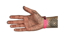 Image 3 of bracelet patient n°8