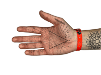 Image 3 of bracelet patient n°3