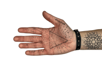 Image 3 of bracelet patient n°2