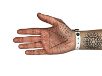 Image 3 of bracelet patient n°1