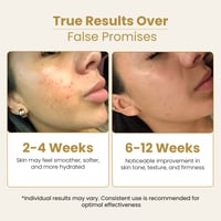 Image 4 of  Glow Up Collection 3-Piece Serum Bundle - FeruGlow, Multi-Peptide Complex, PDRN Glow 