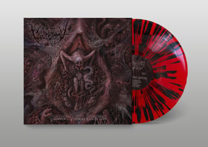 Image of Vulvectomy - Aberrant Vaginal Gestation Vinyl