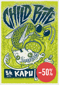 Image 1 of Child Bite